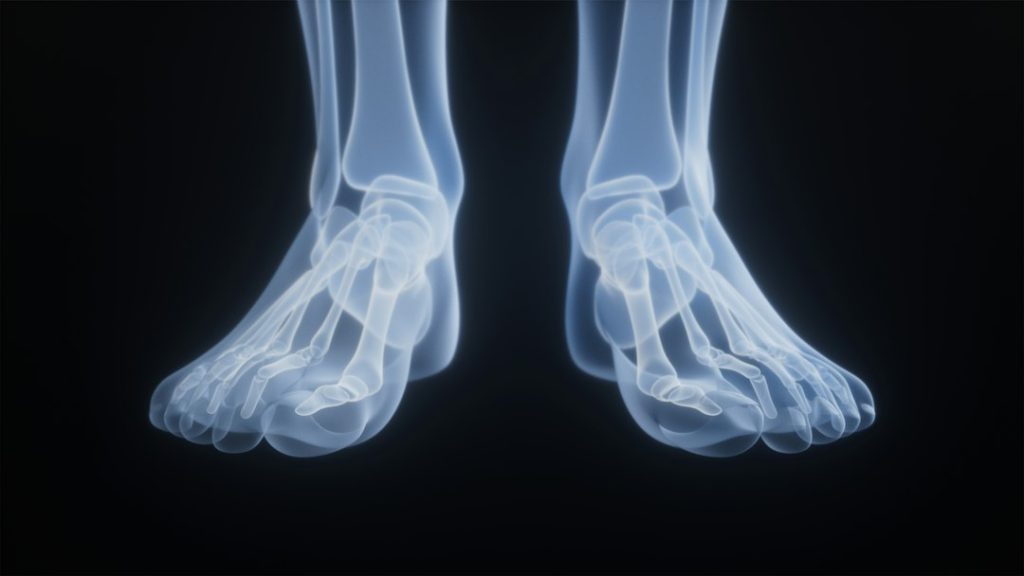 Gout Symptoms vs Arthritis Symptoms: How to Recognize the Differences